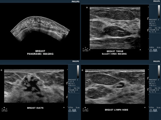 NYMI Associates Breast Ultrasound